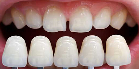 Cosmetic Dentistry