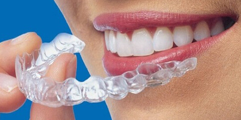 Invisalign