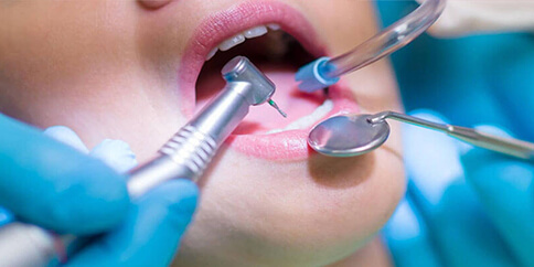 Oral Surgery