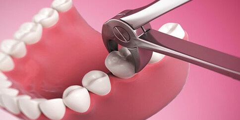 Periodontics