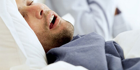 sleep apnea