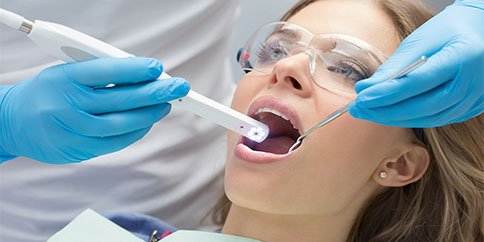 IntraOral Camera