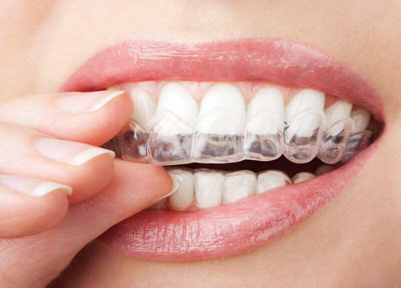 newton dentistry blog