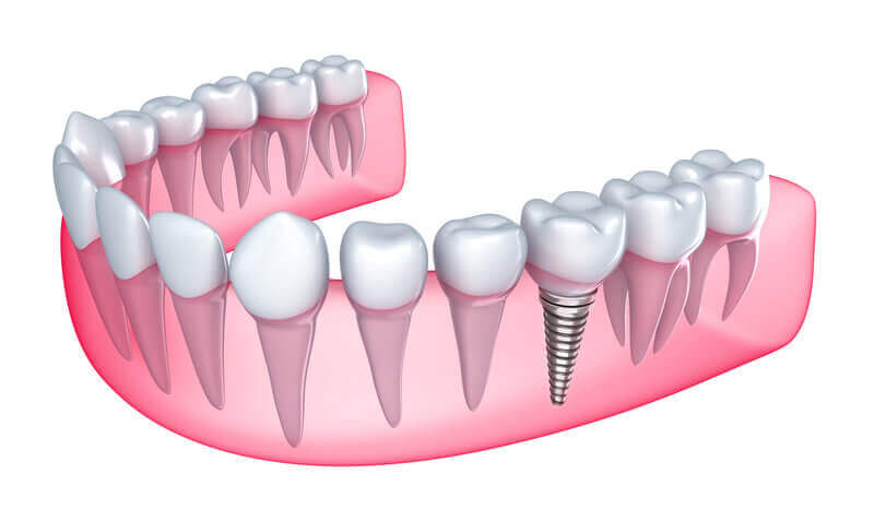 newton dentistry blog