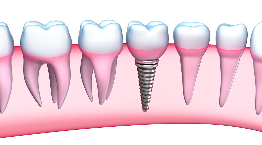 newton dentistry blog