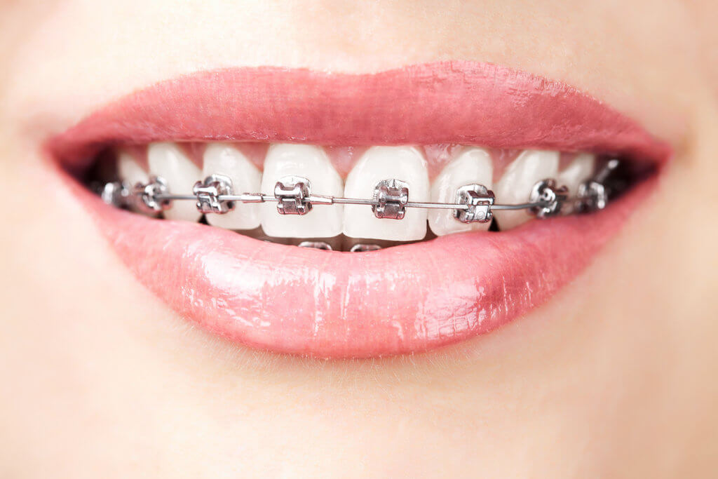 newton dentistry blog