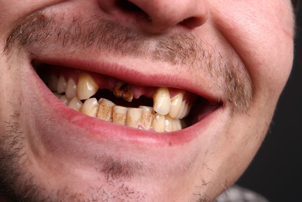 newton dentistry blog