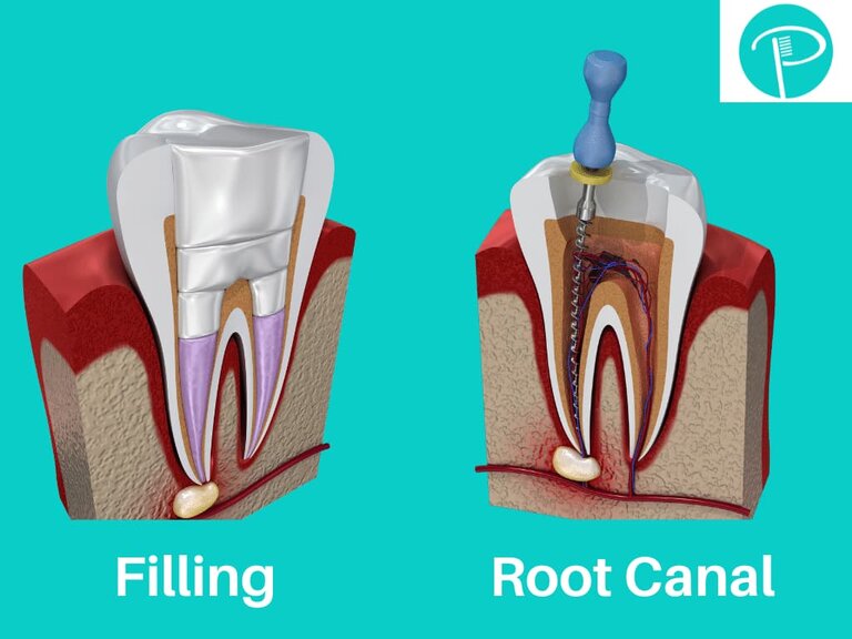 newton dentistry blog